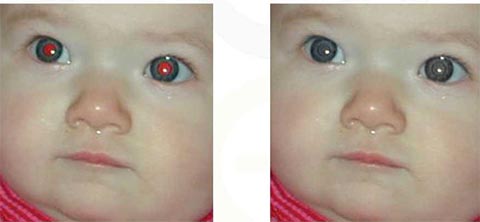 Công cụ giúp khử hiệu ứng mắt đỏ khi chụp ảnh với đèn Flash.