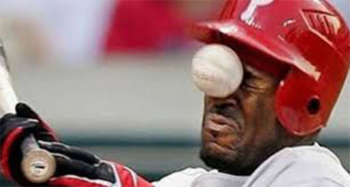 Cầu thủ Baseball bị bóng đập vào mặt
